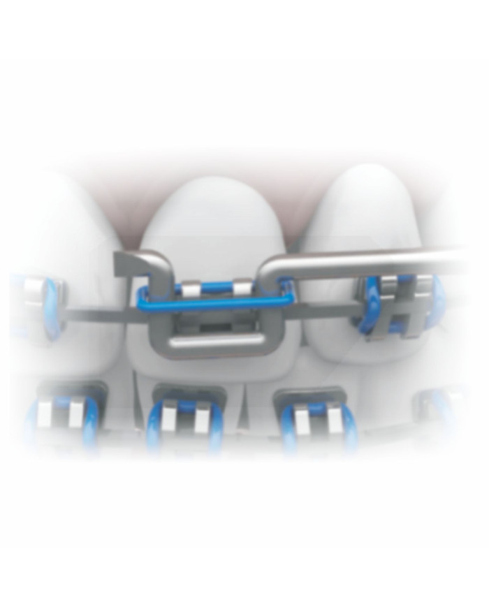 Aplic. Amarr.c/ponta dupla-Inox