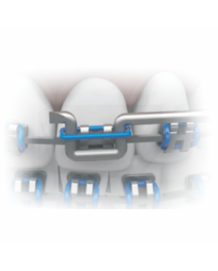 Aplic. Amarr. Plast. c/ponta-Inox