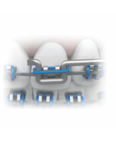 Aplic. Amarrilho - Inox