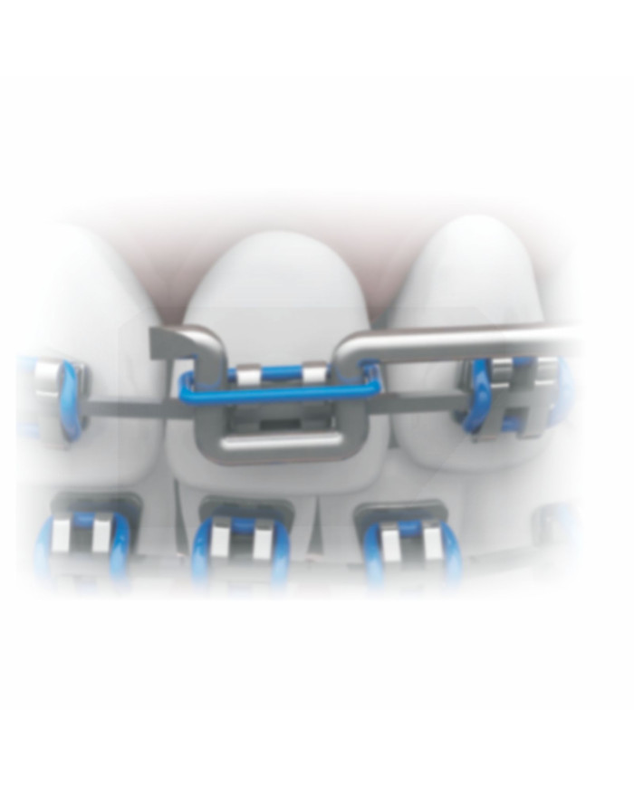 Aplic. Amarrilho - Inox