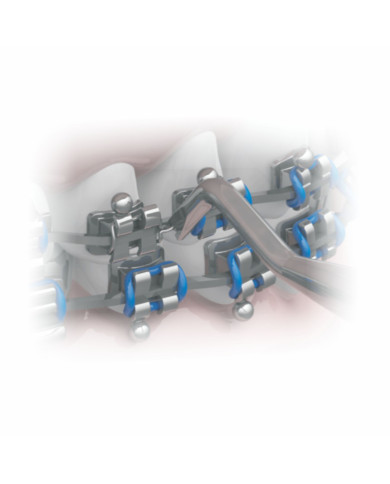 Condutor de Amarrilho Pontas Curvas