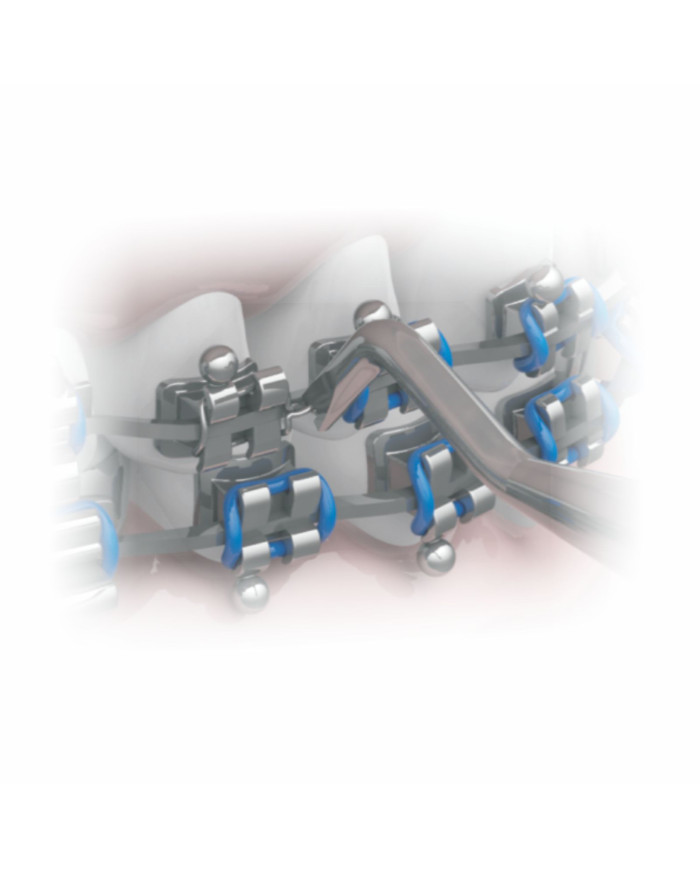 Condutor de Amarrilho Pontas Curvas