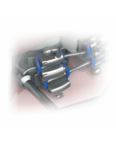 Dobrador Distal - Aberto