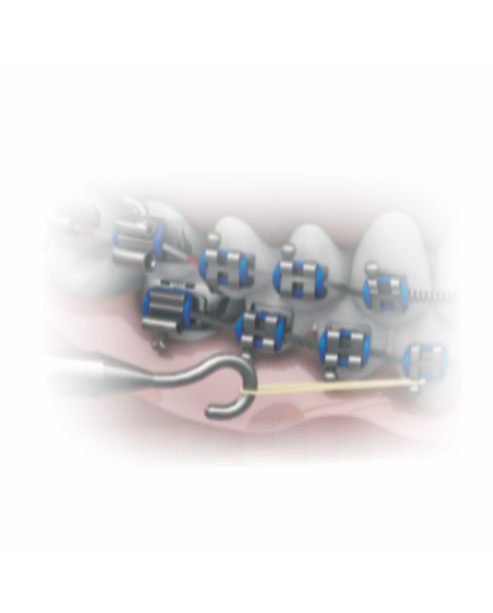 Tensiômetro Ortodôntico Azul 25gf -250gf