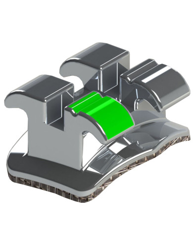 Morelli Sistema M.B.T. - P/Can. Sup/Esq-.022" Morelli Sistema M.B.T. - P/Can. Sup/Esq-.022"