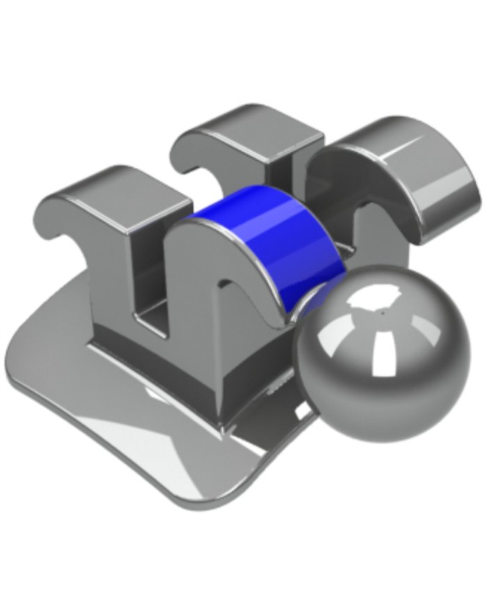 Ricketts Actual - 1°Premolar c/Gan.Inf/Dir- Slot . Ricketts Actual - 1°Premolar c/Gan.Inf/Dir- Slot .