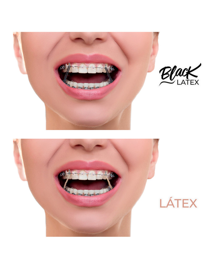 Elástico Intraoral - Antimicrobiano Black Elástico Intraoral - Antimicrobiano Black