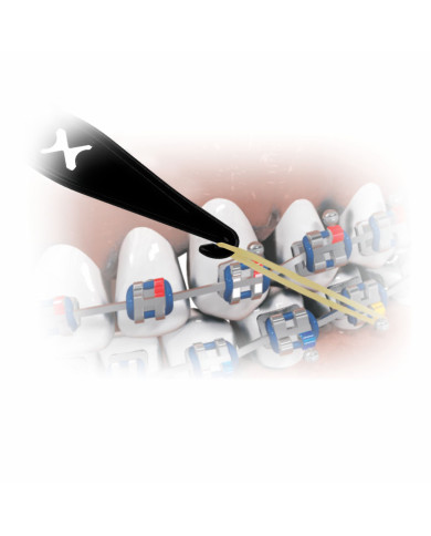 Posicionador de Elásticos 20un