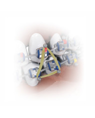 Natural Latex Intraoral Elastics