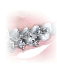 Elásticos Intra-oral Silicone