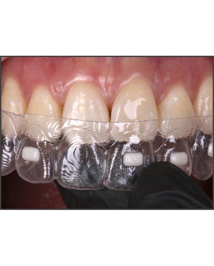 Composito Vittra APS Unique FLOW - seringa 2g