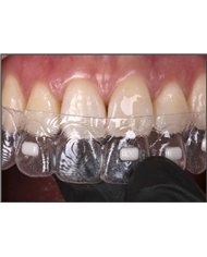 Composito Vittra APS Unique FLOW - seringa 2g