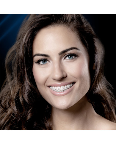 Kit Roth CERAMIC SLI .022"-Can.9º-gancho Can./Pre Kit Roth CERAMIC SLI .022"-Can.9º-gancho Can./Pre